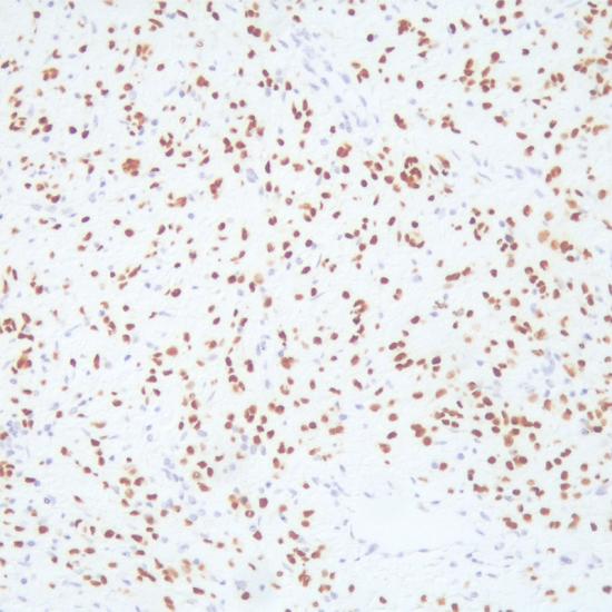Reagente de anticorpo SOX-10 para imuno-histoquímica