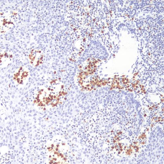 Reagente de anticorpo MUM1 para imuno-histoquímica