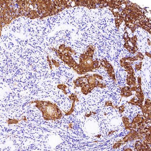 p16 Antibody Reagent for Immunohistochemistry